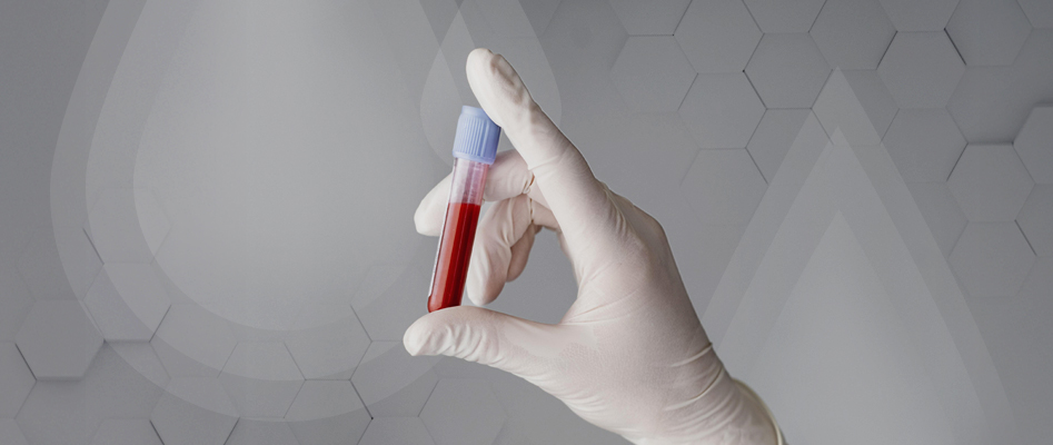 Hemophilia: An In-Depth Examination of the Bleeding Disorder